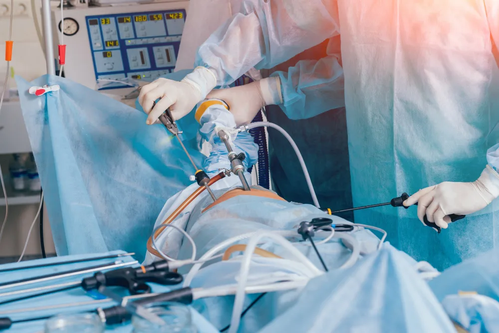 Miotomía de Heller en CDMX: Tratamiento quirúrgico de la acalasia esofágica